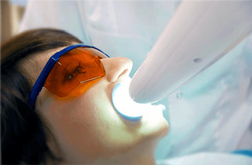 Understanding the Causes of Teeth Sensitivity Abingdon