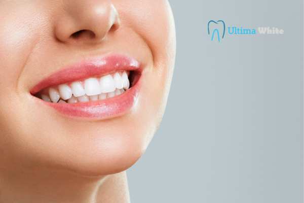 Common Mistakes That Can Ruin Your Whitening Results Abingdon