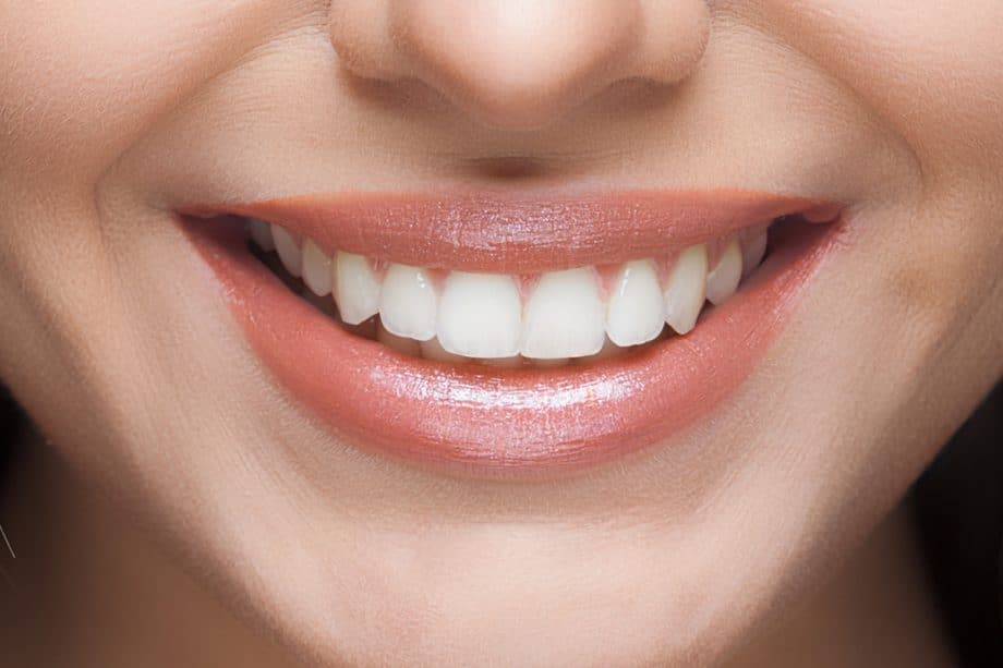 The Role of a Balanced Diet in Long-Term Whitening Results Abingdon