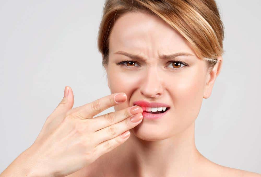 Does Laser Teeth Whitening Hurt or Cause Sensitivity Abingdon?
