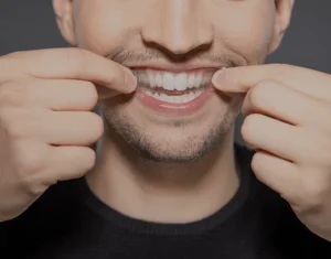 Overview of Home Teeth Whitening Kits Abingdon