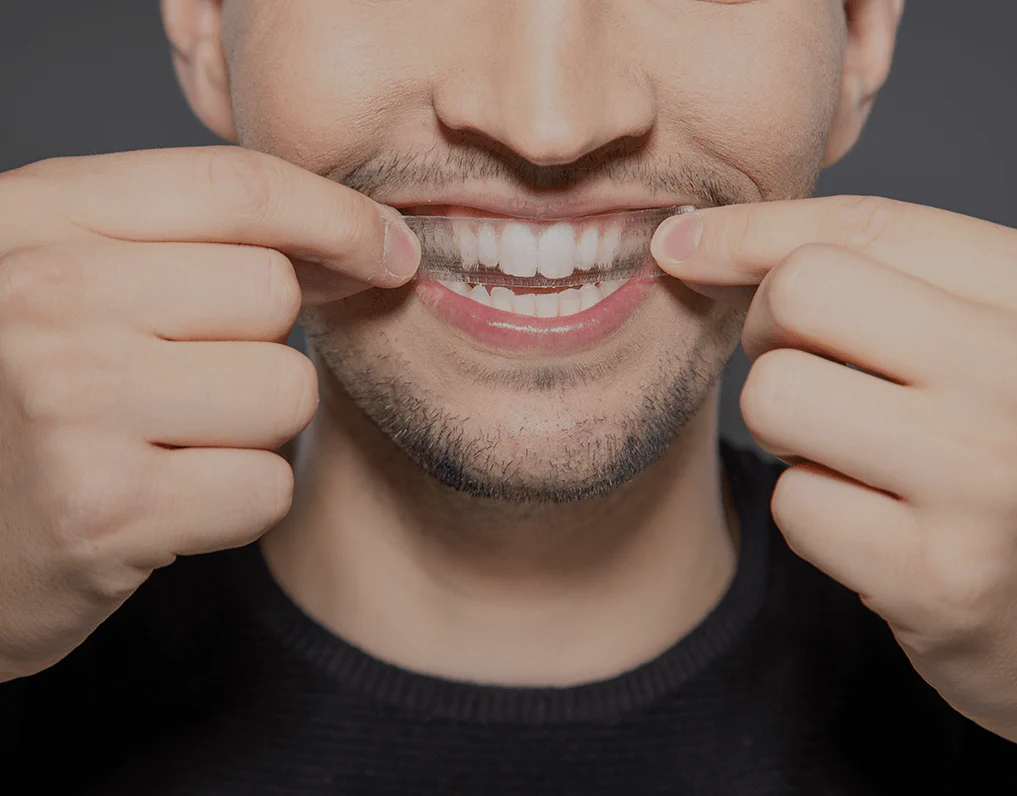 Can You Whiten Natural Teeth Without Harsh Chemicals Abingdon?