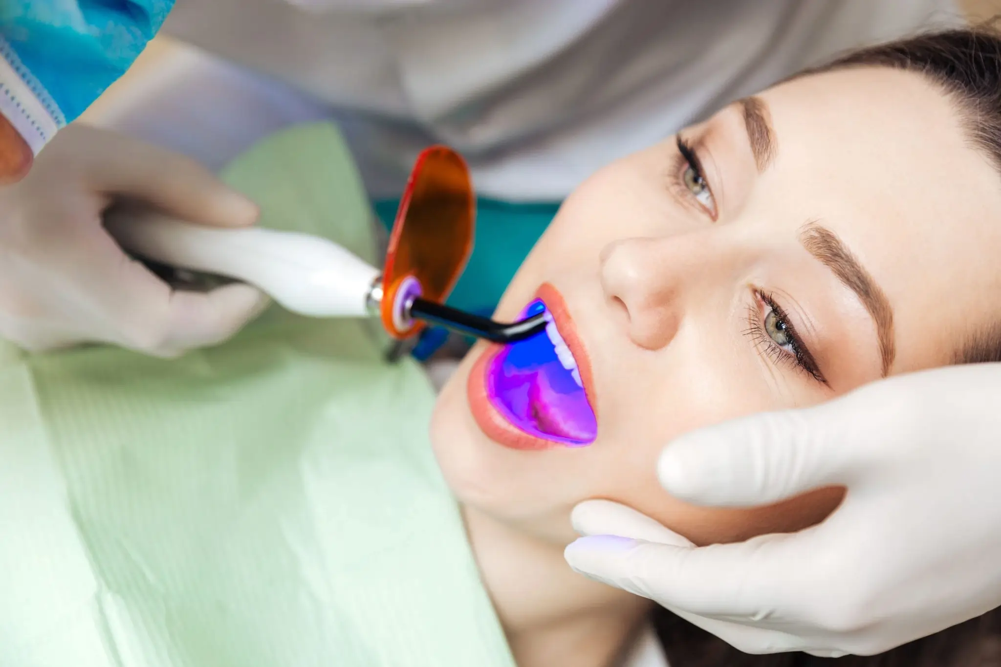 What Does Pain Feel Like During and After Laser Teeth Whitening Abingdon?