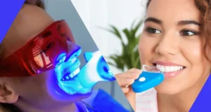 Impact of Home Kits Abingdon versus Professional Teeth Whitening Treatments