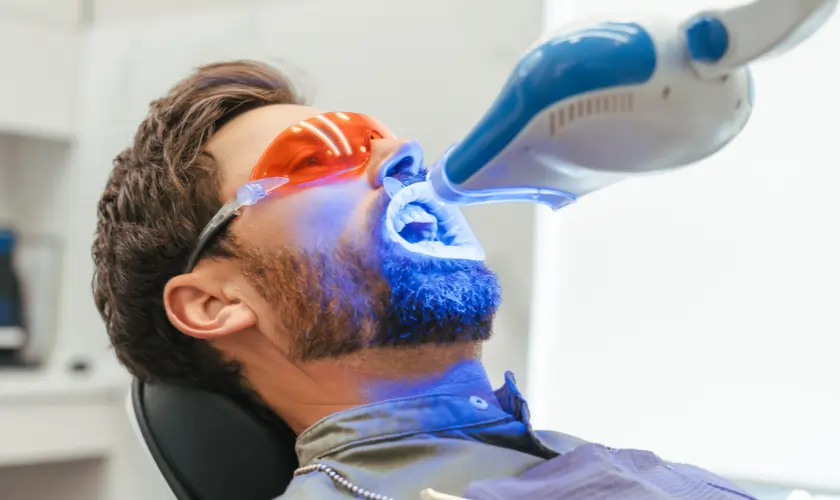 Is Laser Teeth Whitening Worth It? Pros, Cons, and Alternatives Explained Abingdon