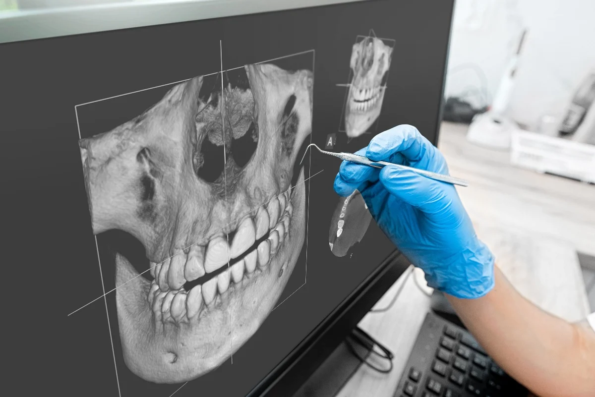 How Is AI Transforming Dental Treatment Planning Abingdon?