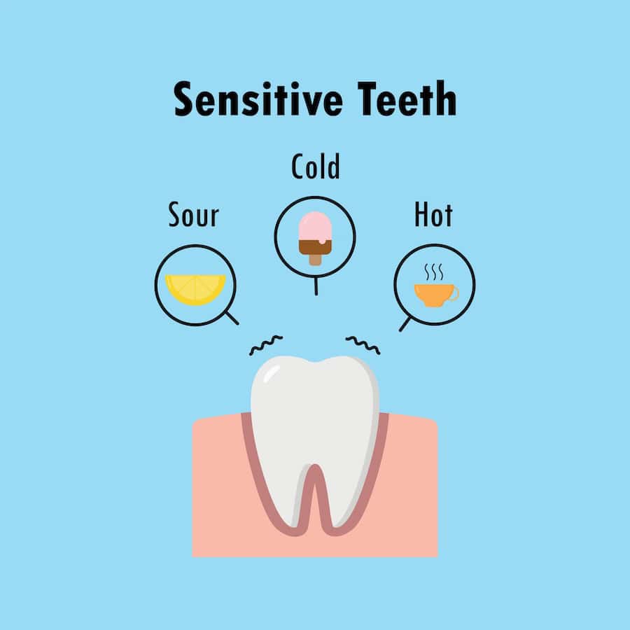 Why Do Teeth Become Sensitive After Whitening Treatments Abingdon?