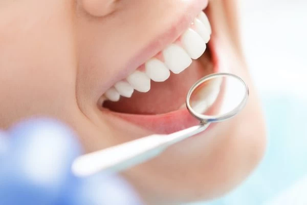 Preventing White Spots on Teeth Abingdon