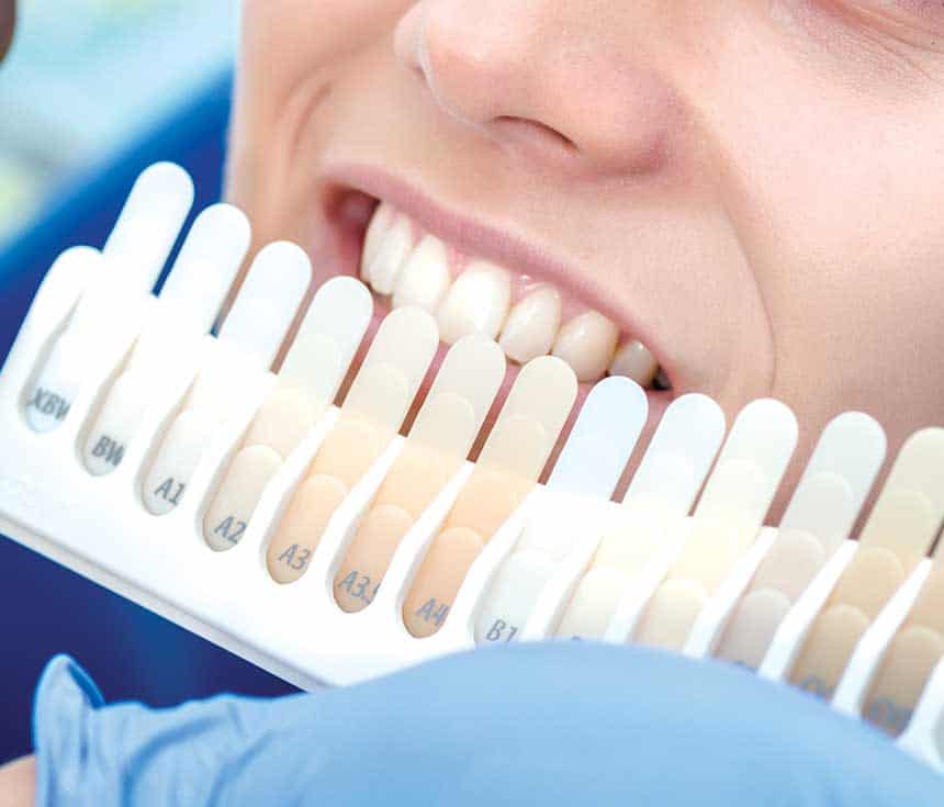 Is Laser Teeth Whitening Worth It for a Brighter, Confident Smile Abingdon?