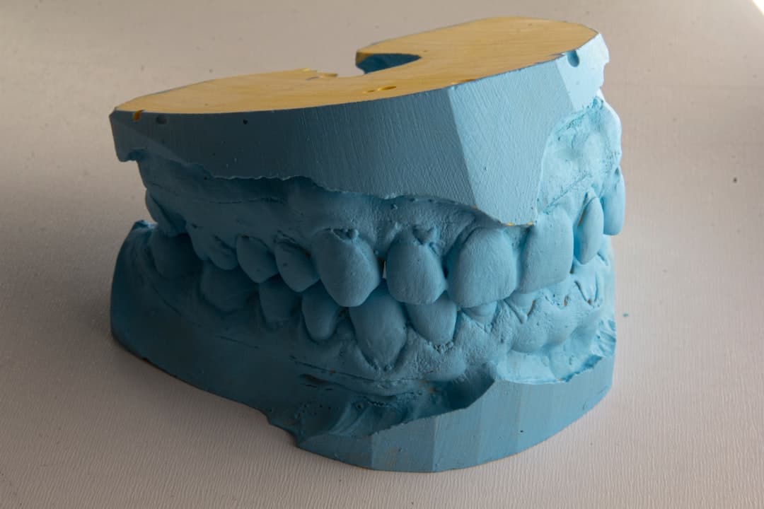 How Do Dental Implants Improve Jawbone Health and Oral Function Abingdon?