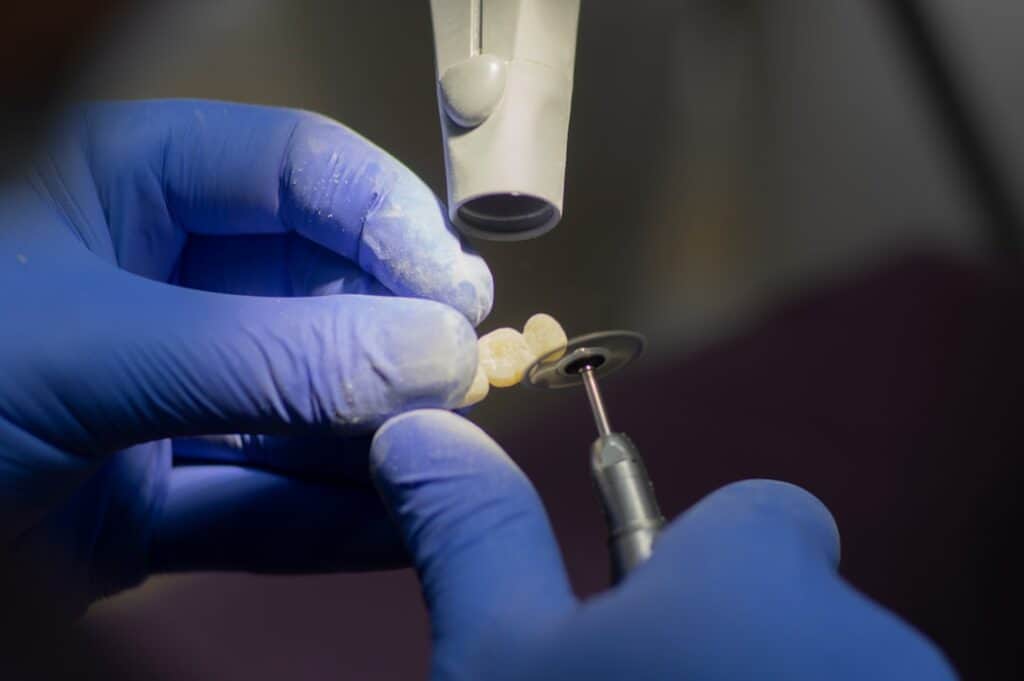 Customised Dental Solutions: Crowns, Aligners, and Implants Abingdon