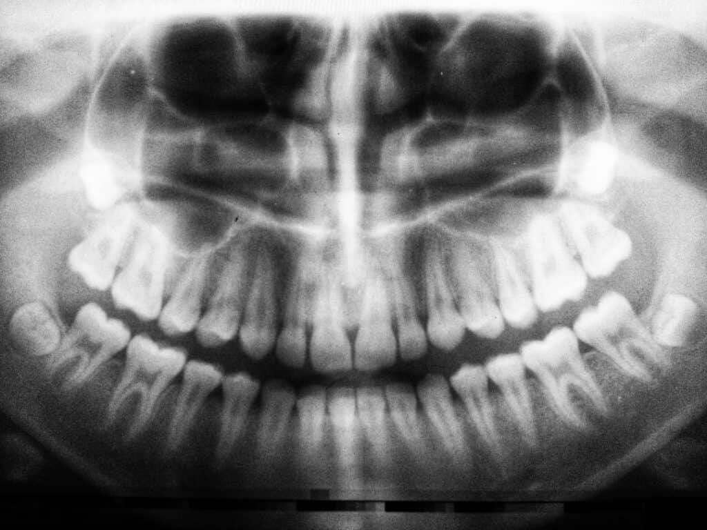 The Future of 3D Printing in Oral Healthcare Abingdon